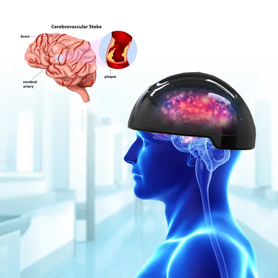 Transcranial Magnetic Stimulation Pbm Photobiomodulation Therapy Photobiomodulation Helmet