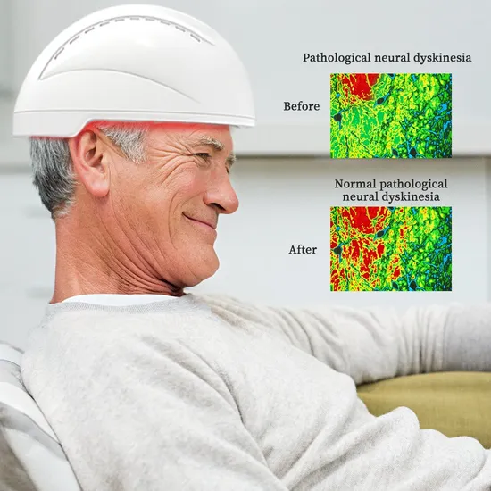 Suyzeko Neuro Stimulation Helmet Infrared Light Therapy Machine for Photobiomodulation Therapy